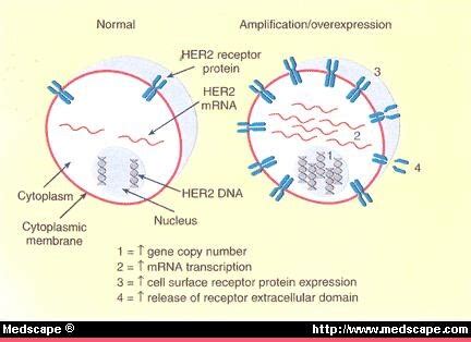 HER2 in Breast Cancer--What Does it Mean?