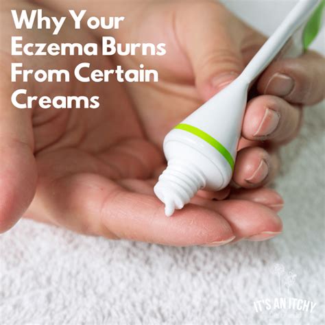 Why Your Eczema Burns From Certain Creams