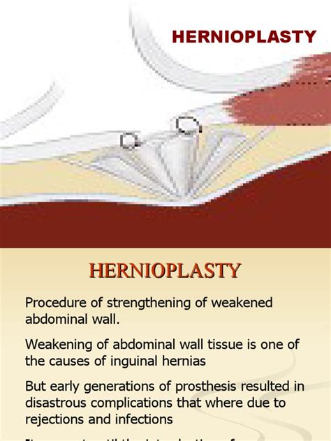 Hernioplasty | PDF | Surgery | Clinical Medicine