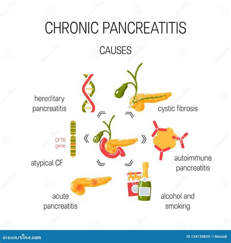 Causes of Chronic Pancreatitis Concept. Vector Illustration Stock ...