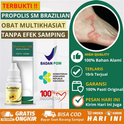 Jual Obat Cacing Pasir Obat Cacing Larva Pasir Cacing Tambang Di Kulit