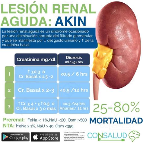 CONSALUD ENARM on Instagram FlashCardsCONSALUD LESIÓN RENAL AGUDA