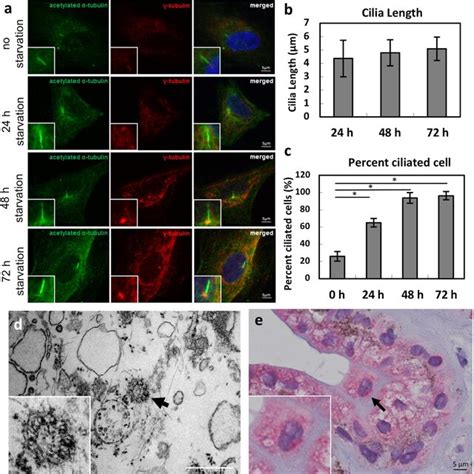 Immunostaining For TRPP2 Co Localized To Primary Cilia In HNPCE Cells