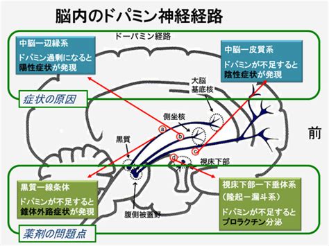 統合失調症の薬にはどのような効果と副作用があるのか | 医者と学ぶ「心と体のサプリ」