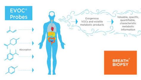 Owlstone Medical Presents Data Demonstrating Progress In Development Of