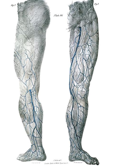 Leg Veins Photograph by Sheila Terry/science Photo Library - Pixels