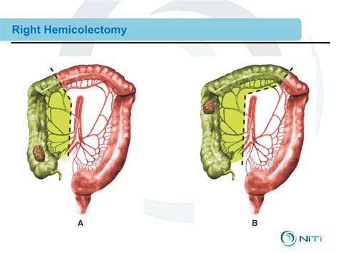 Combined 12 clinical training--surgical procedures | PPT