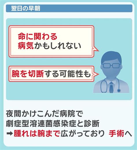 “致死率3倍”『劇症型溶連菌』新たな変異株「m1uk」急拡大 治療法と予防法を解説！