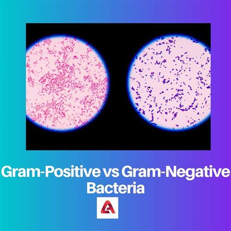 Gram Positive Vs Gram Negative Cell