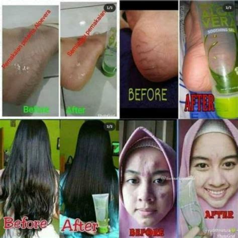 Jual Natura Aloe Vera Soothing Gel Nav Shopee Indonesia