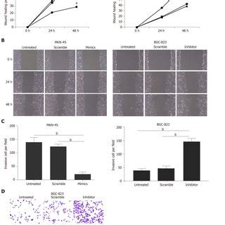 Overexpression Of Mir A Suppressed Gastric Cancer Cell Migration And