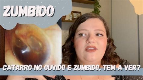 Ouvido Entupido E Zumbido - Entupimento de Ouvido e Zumbido: Causas e Soluções | Actualizado abril 2026