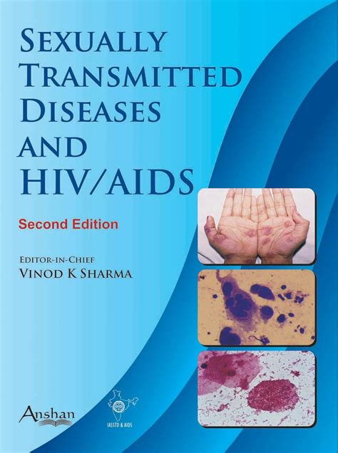 Buy Sexually Transmitted Diseases And Hiv And Aids 2e Book Online At Low