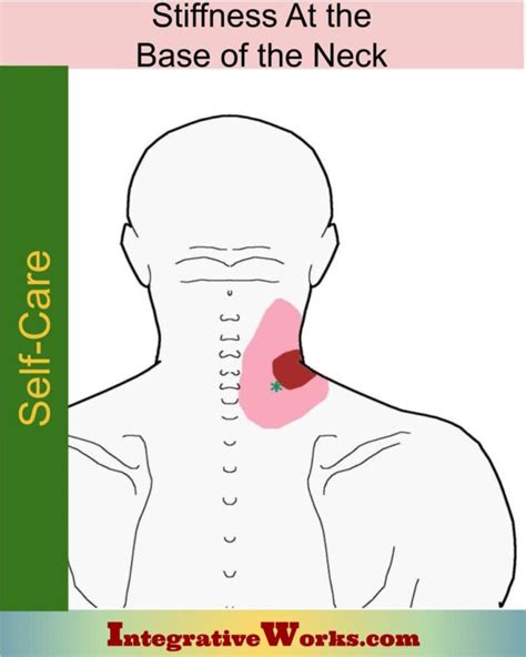 care stiffness   base   neck integrative works