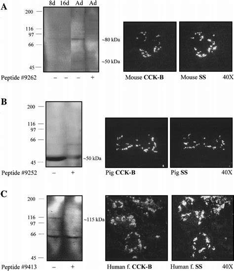 Western Blots And Indirect Immunofluorescence Of The Pancreatic CCK B