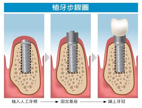 健康刊物 全民健康基金會