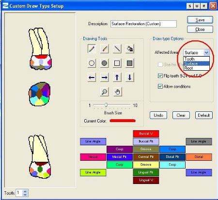 Eaglesoft Chart Setup - Best Picture Of Chart Anyimage.Org