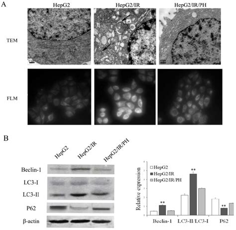 Analysis Of Autophagy Activation In HepG2 IR Cells A Ultrastructure