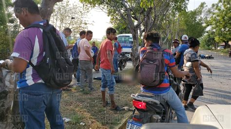 Por Andar Sin Casco Motociclista Pierde La Vida Tras Accidentarse En