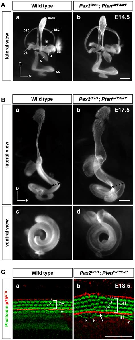 Inner Ear Phenotypes In Pten Conditional Knockout Cko Mice A