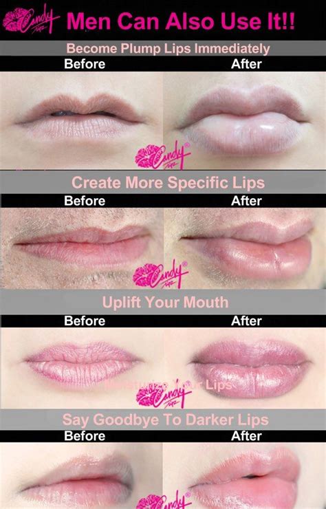 Natural Lip Plumping Techniques - werohmedia