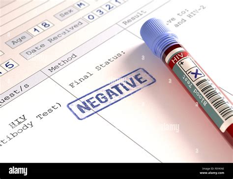 Image concept with the result of the HIV test Stock Photo - Alamy