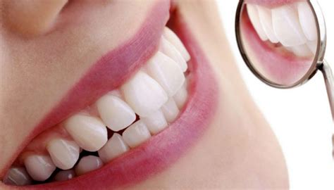 Cinco ventajas de la resina dental | Odontotecks