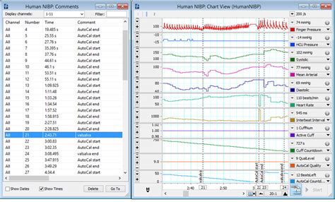 Human Non Invasive Blood Pressure NIBP ADInstruments