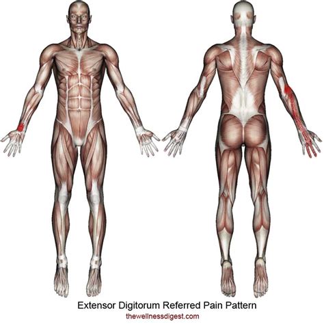 Extensor Digitorum Muscle Pain The Wellness Digest