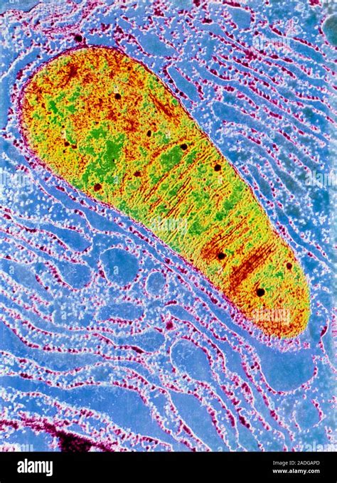 Las mitocondrias Transmisión Color micrografía de electrones de la