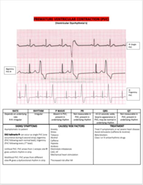 Pvcs Ekg Interpretation Etsy