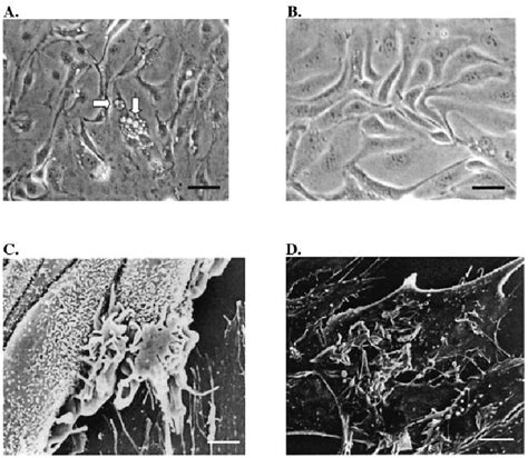 Epithelial Cell Culture Of Normal Fallopian Tube Epithelial Cells After