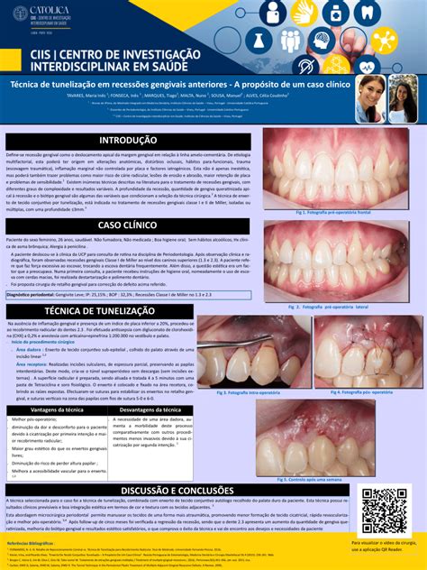 Pdf T Cnica De Tuneliza O Em Recess Es Gengivais Anteriores A