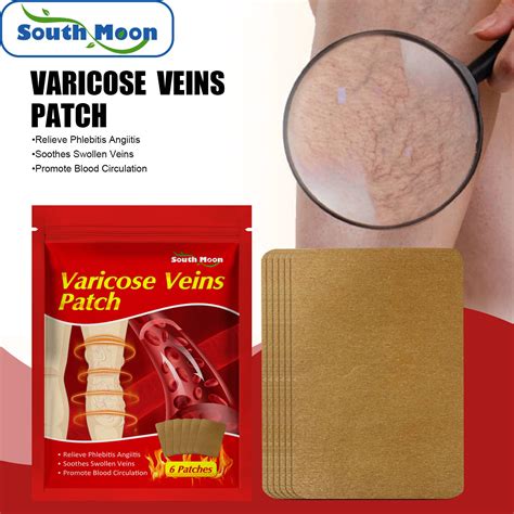 South Moon Varicose Veins Patch Vasculitis Phlebitis Spider Legs