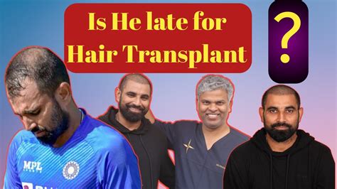 Mohammed Shami S Incredible Hair Transformation Exclusive Coverage Of