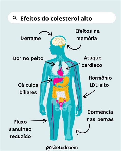 Colesterol Ldl Alto Síntomas - Sintomas De Colesterol Alto Síntomas De Colesterol: 3 Señales De