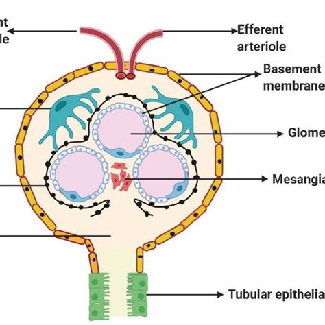 Large heterogeneously enhancing exophytic mass lesion involving left ...