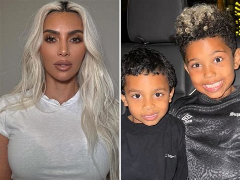 Kim Kardashian Reveals Her Son Has a Rare Skin Condition