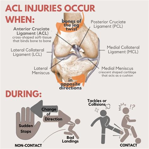 What Is An Acl Injury