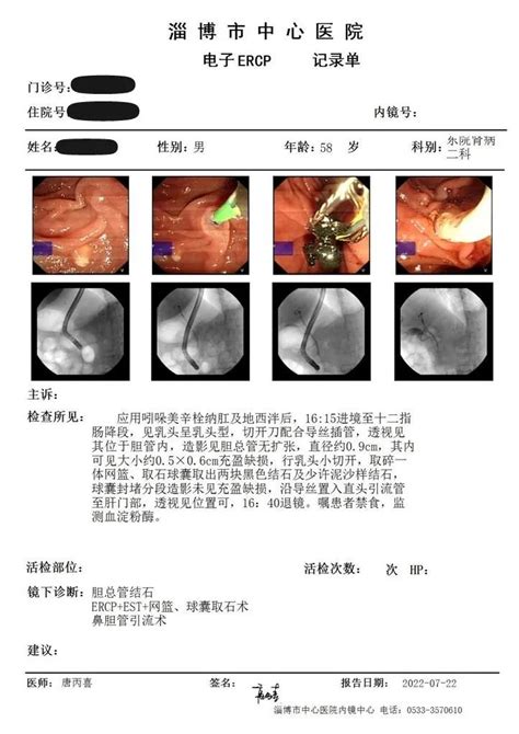 “mdt＋全院一张床”——市中心医院为尿毒症患者成功实施ercp取石术胆总管结石ercp尿毒症胰腺炎肾病科胆管 健康界