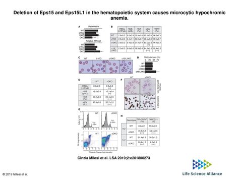 Deletion Of Eps15 And Eps15L1 In The Hematopoietic System Causes