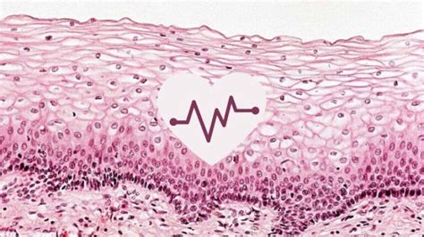 Epithelial Cell Abnormality Causes Symptoms And Treatment