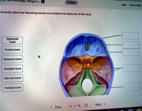 Correctly Label The Following Bones And Anatomical Features Of The