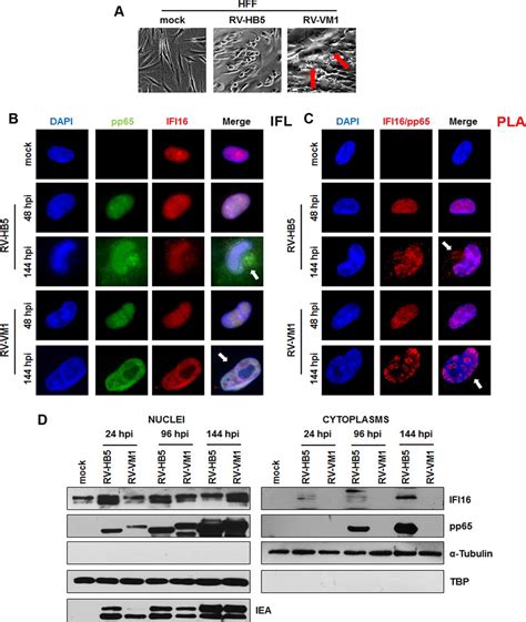 Regulatory Interaction Between The Cellular Restriction Factor Ifi