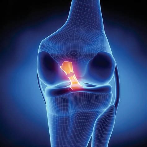 3 Causes Of Knee Joint Pain