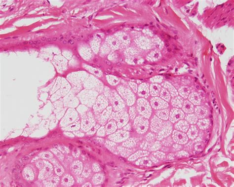 Histología en Imágenes GLANDULA SEROSA O MUCOSA