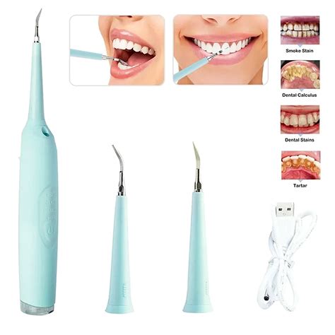 KKL Electric Dental Calculus Remover, Dental Calculus Remover Teeth ...