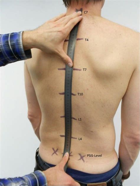 Spine Landmarks Human Body Anatomy Body Anatomy Medical Anatomy