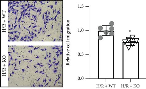 KDM3A Knockout Exaggerated H R Induced CMEC Injury And Dysfunction A