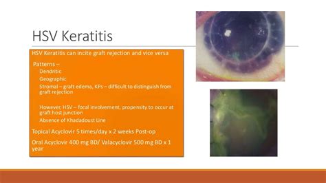 Keratoplasty associated complications